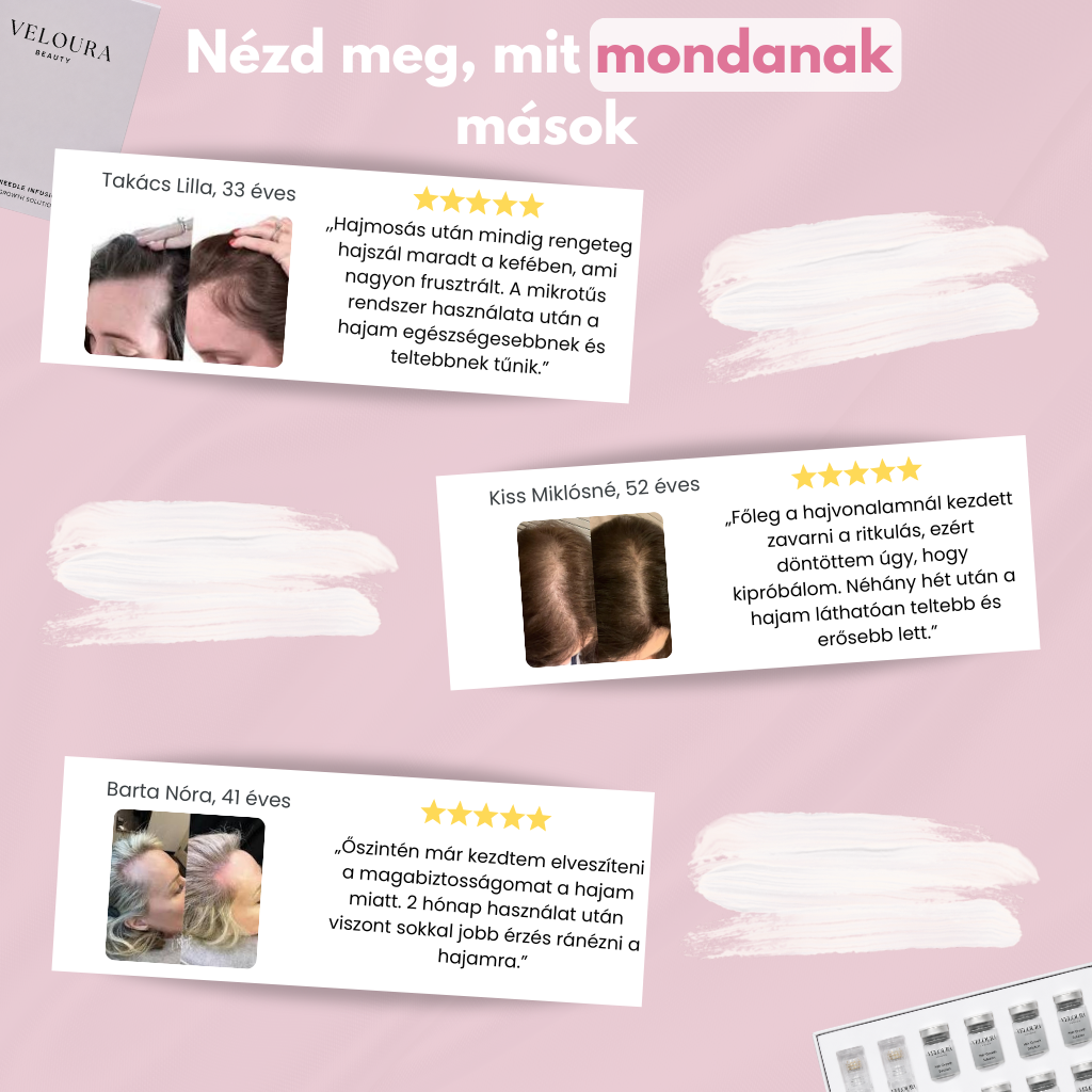 Veloura MicroFusion™
