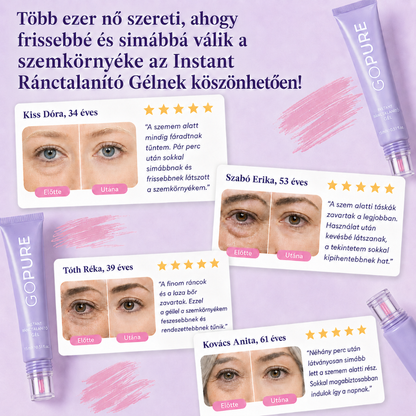 Instant Ránctalanító Gél